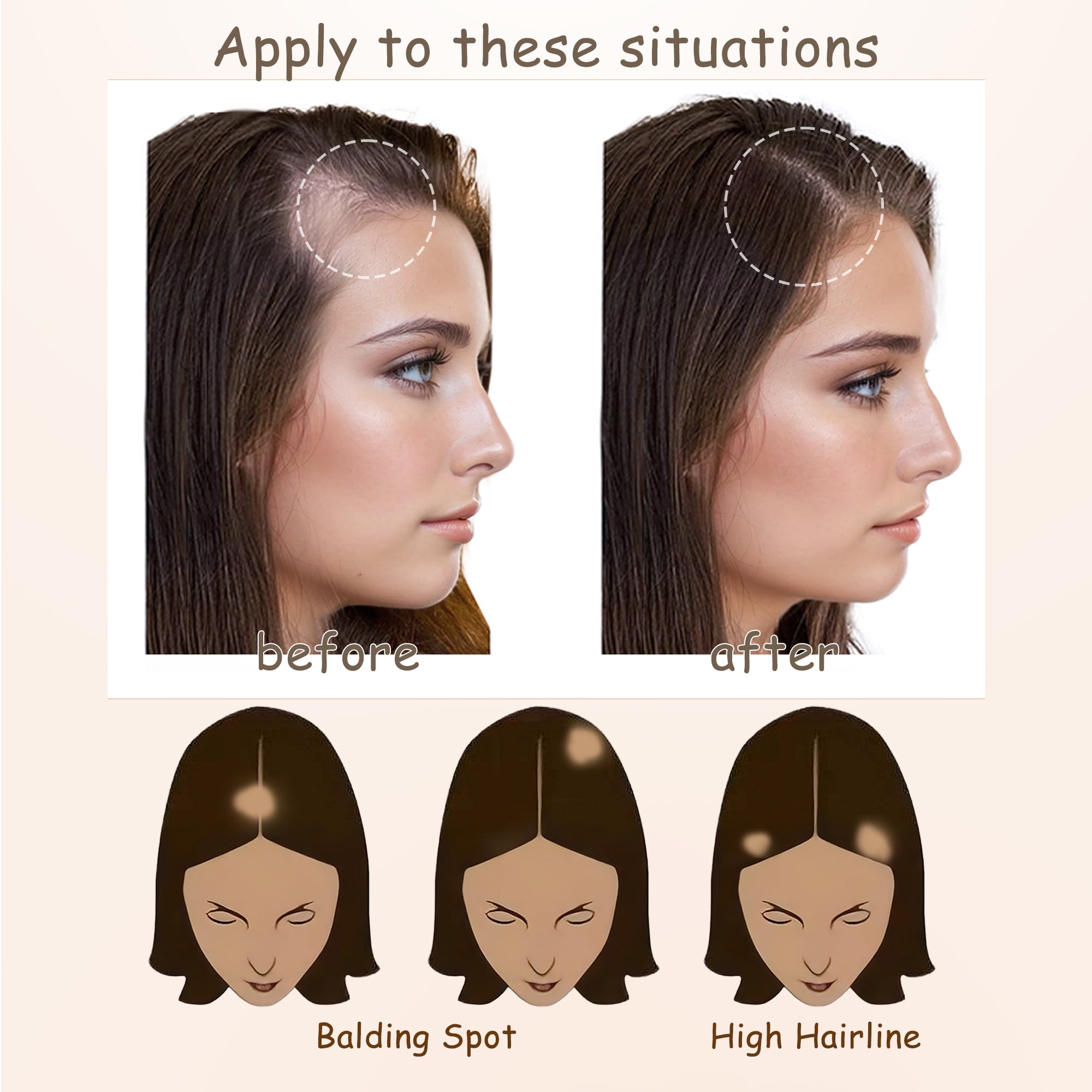 Human Hair Tape-On Triangle Hair Patch for Hair Loss Temples 2Pcs Temple Hair Patches Human Hair Pieces Skin PU Cover-Up  main image 3
