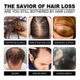 thumbnail image 5 of Rice Water Protein Shampoo Bar Soap Moisturizing Anti Hair Loss Hair Growth Soap, 5 of 5