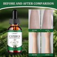 thumbnail image 3 of Cyperus Rotundus Oil - Natural Cyprus Oil for Hair Removal, Reducing Body Hair Growth, Moisturizing & Soothing, Smooth Skin, Ideal for All Skin Types, 3 of 5