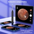 thumbnail image 7 of VITCOCO Ear Wax Removal, 1296P FHD Wireless Otoscope Earwax Removal Kit with 6 LED Lights, iPhone, iPad & Android Smart Phones, 7 of 7