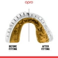 thumbnail image 2 of OPRO Gold Level Mouth Guard For Braces – Mouthguard for Boxing, MMA & Football (White, Adult), 2 of 7