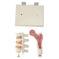 thumbnail image 2 of Osteoporosis Model, Osteoporosis Spine Model   for Clinical Teaching, 2 of 8