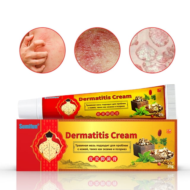 Crema calmante para la psoriasis y la dermatitis para una piel sana Alivio natural del eczema