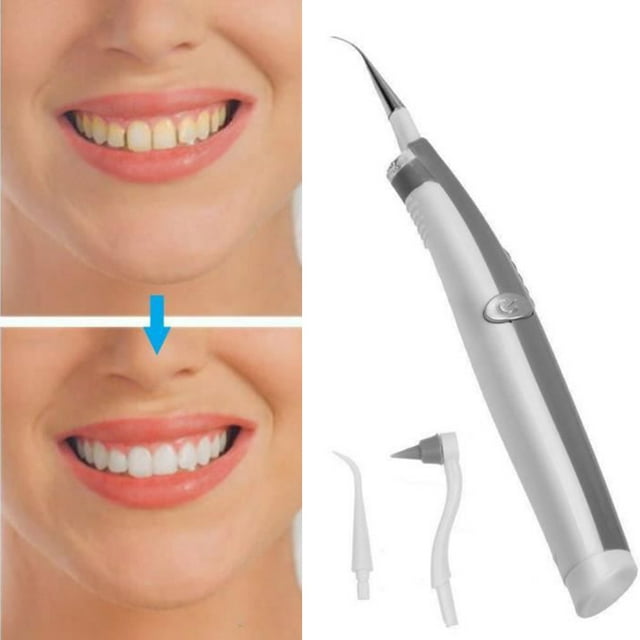 Borrador eléctrico sónico para manchas de dientes, eliminador de placa y manchas de dientes, Kit de herramientas de belleza vibratorias para dientes