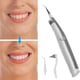 thumbnail image 2 of Borrador eléctrico sónico para manchas de dientes, eliminador de placa y manchas de dientes, Kit de herramientas de belleza vibratorias para dientes, 2 of 7