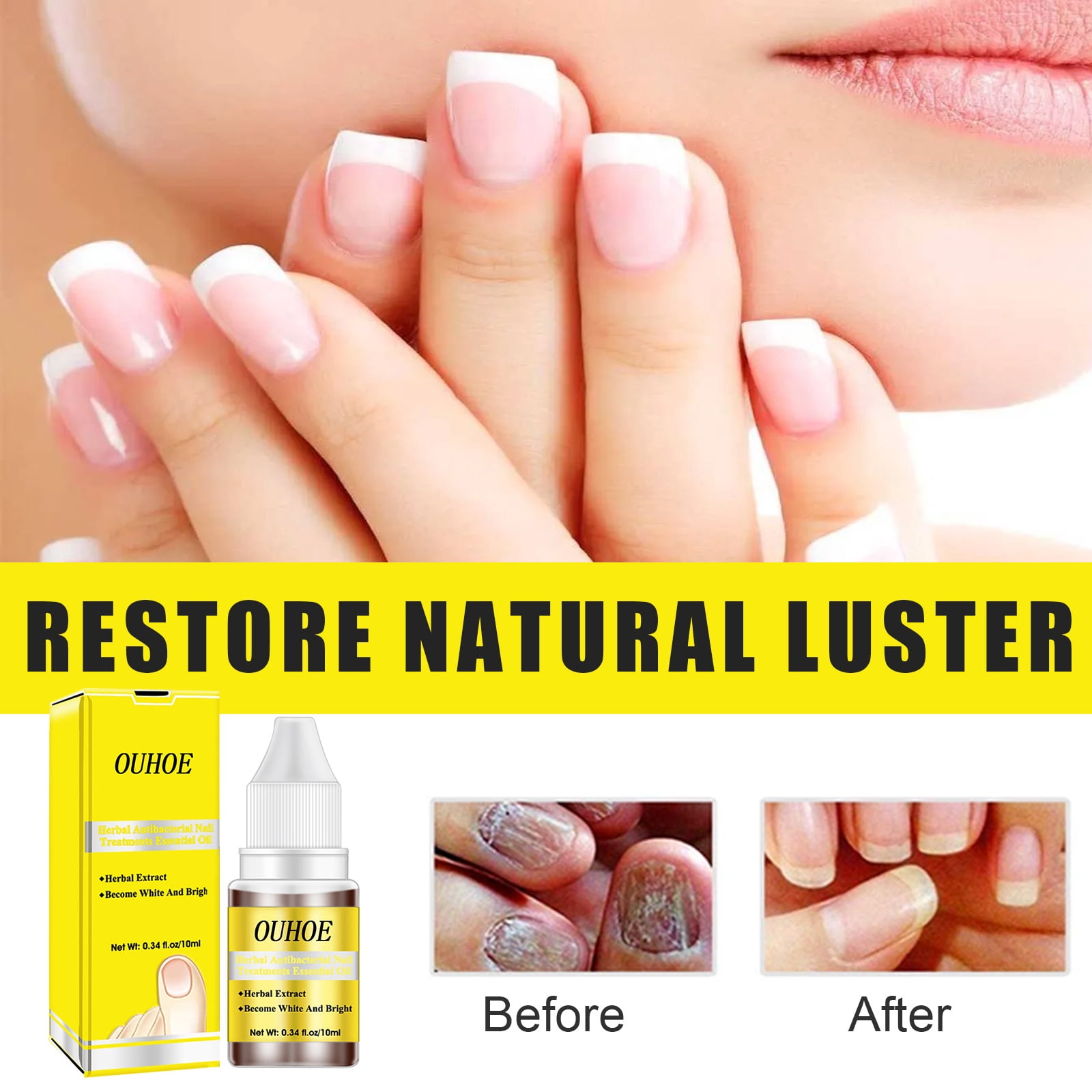 Fungus 2 man products to support nail and foot fungus THE ORIGINALS nail