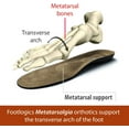 thumbnail image 3 of Footlogics Orthotic Shoe Insoles with Built-in Raise for Ball of Foot Pain, Morton’s Neuroma, Flat Feet - Metatarsalgia, Pair Full Length - L (Men's 10-11.5, Women's 11.5-13), 3 of 5