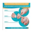 thumbnail image 2 of Corrector de juanetes, separador de dedos, 2 of 4