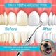 thumbnail image 2 of Herramienta profesional para raspar sarro Dental, selección Dental, eliminador de sarro de doble punta para dientes, removedor de placa, raspador de dientes, 2 of 4