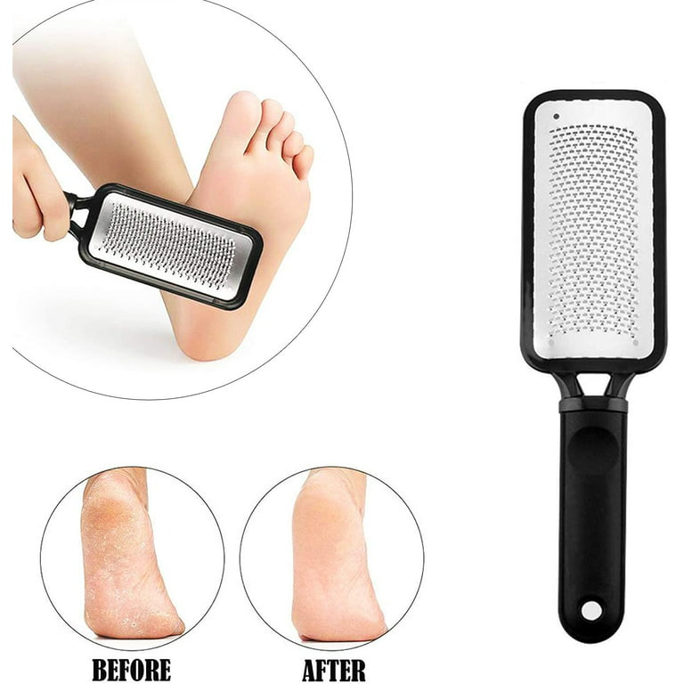 Maryton Foot Exfoliator File Scrubber Sponge Pedicure Tool Callus Remover  for Feet, Salon Foot Scrub Pads Pedi Gifts for Men Women, 2pcs
