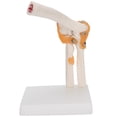thumbnail image 1 of Knee Joint Model, Lifelike Flexible Elbow Joint Model, With Ligaments For Patient Education, 1 of 8