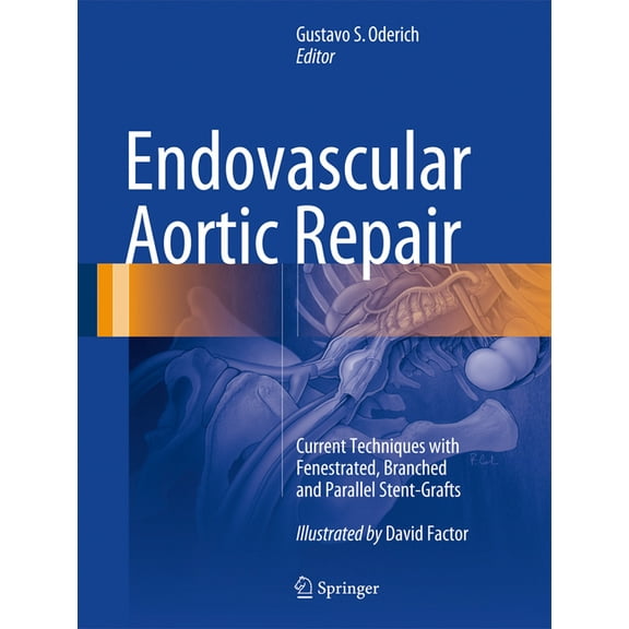 Endovascular Aortic Repair: Current Techniques with Fenestrated, Branched and Parallel Stent-Grafts, (Hardcover)