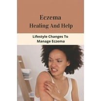 Eczema Healing And Help: Lifestyle Changes To Manage Eczema: What Foods To Eat To Cure Eczema (Paperback)
