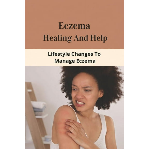 Eczema Healing And Help: Lifestyle Changes To Manage Eczema: What Foods To Eat To Cure Eczema (Paperback)