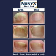 NonyX Nail Gel 4 Oz