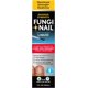 thumbnail image 1 of Fungi-Nail Anti-Fungal Liquid Solution, Kills Toe Fungus and Tolnaftate & Clincially Proven to Cure and Prevent Fungal Infections, 1 Oz (Pack of 1), 1 of 7