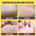 thumbnail image 2 of Foot Care Foot Spray Anti-drying and Moisturizing Banana Coconut Foot Care Spray for Dry and Rough Skin, 2 of 9
