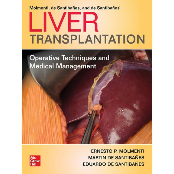 Liver Transplantation: Operative Techniques and Medical Management, (Hardcover)
