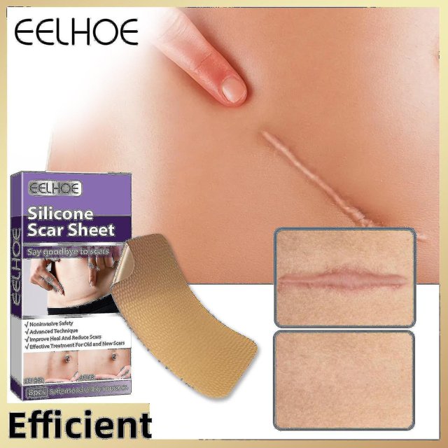 unids/caja de pegatina para eliminación de cicatrices quirúrgicas, crema de Gel para manchas de acné, tratamiento de cicatrices quirúrgicas, blanqueamiento suave de la piel del cuerpo y la cara