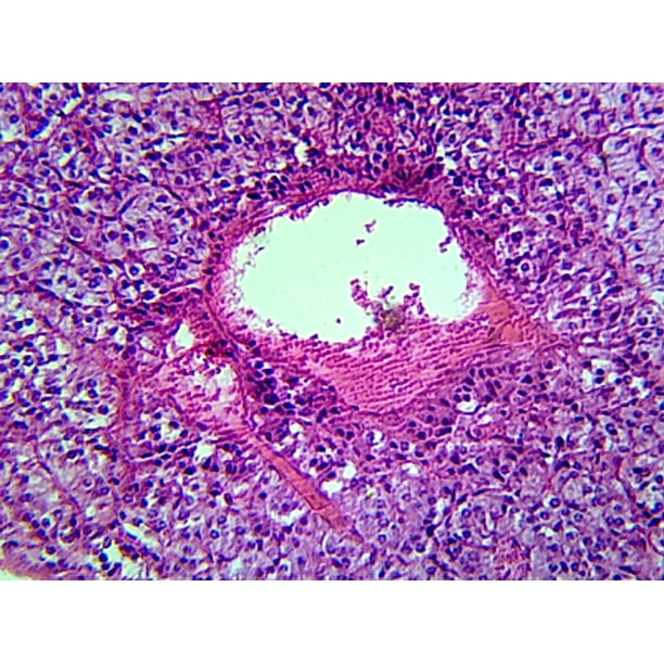 Adrenal Glands, Mammalian; Showing Cortex and Medulla; Section ... Biology Diagrams