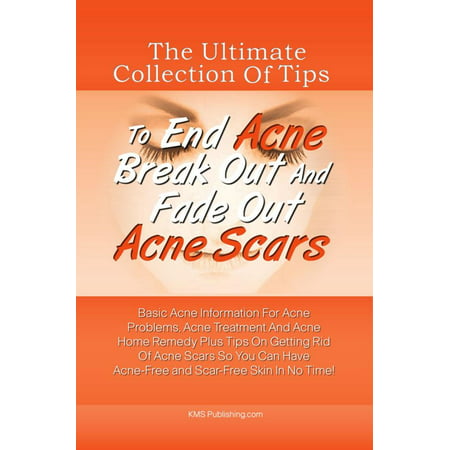 The Ultimate Collection Of Tips To End Acne Break Out And Fade Out Acne Scars -