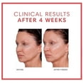 thumbnail image 6 of Consult Beaute Volumagen TRIO Skin Care Cream - 0.5 fl oz, 1.7 fl oz, 2 fl oz, 6 of 11