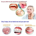thumbnail image 2 of 10 Pack Scented Dental Oral Care Orthodontic Wax for Brace Wearers, 2 of 5