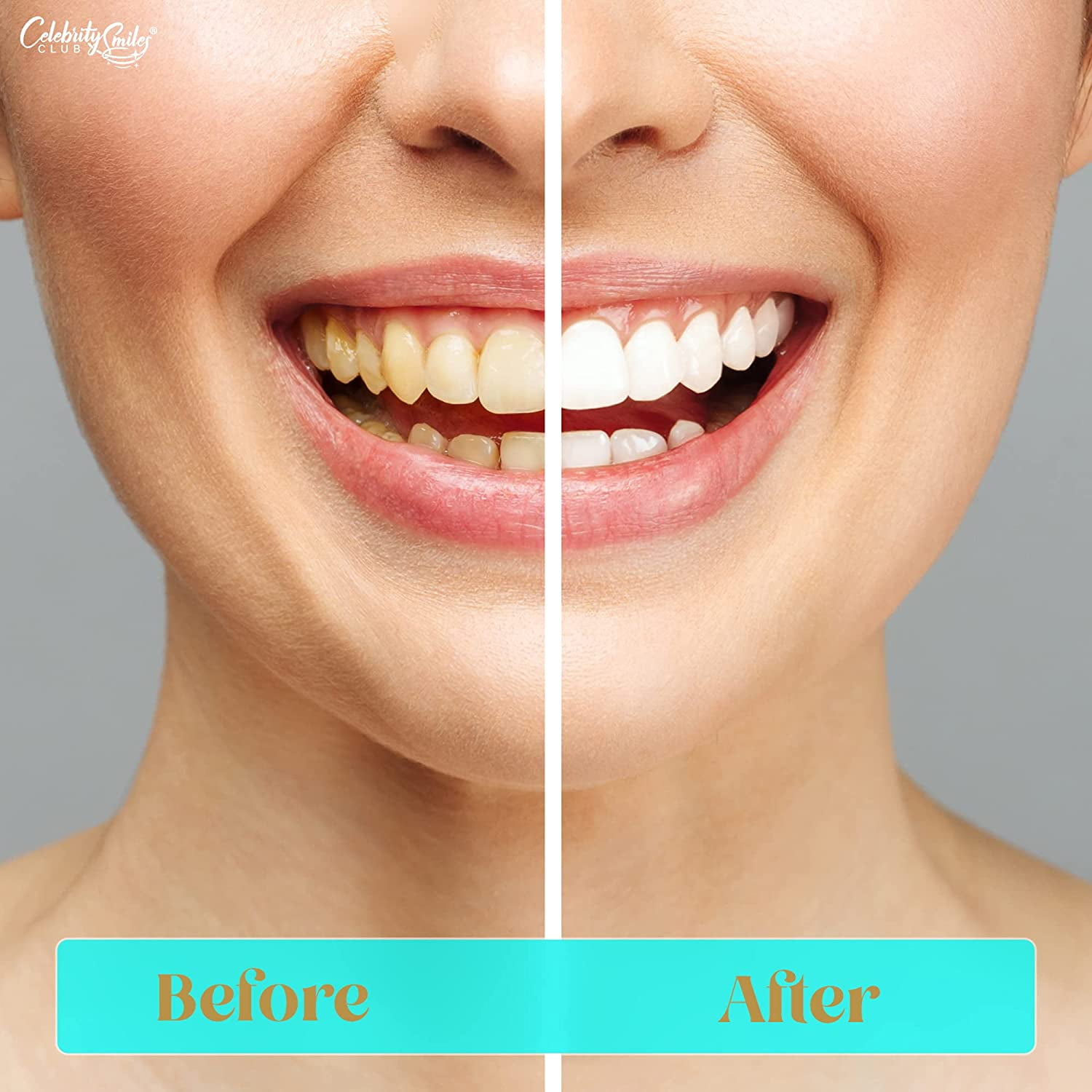 【高知インター店】 Celebrity 32 with Kit Whitening Teeth Smile Bright Smiles® コレクション