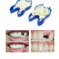 thumbnail image 3 of Temporary Dentures Occlusal Upper Dentures, Veneers, Missing Teeth, Broken Teeth And Interdental Spaces, Front Teeth + Back Teeth, 3 of 5