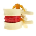 thumbnail image 1 of Modelo De Demostración De Herniación Discal Degenerativa De s Vértebras es De Vertebral Anatómica, Herramientas CUTICAT Estatua de protrusión del disco lumbar, 1 of 7