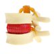 thumbnail image 1 of Nuevo o De Protrusión D Intervertebral De Zulema Estatua de protrusión del disco lumbar, 1 of 7