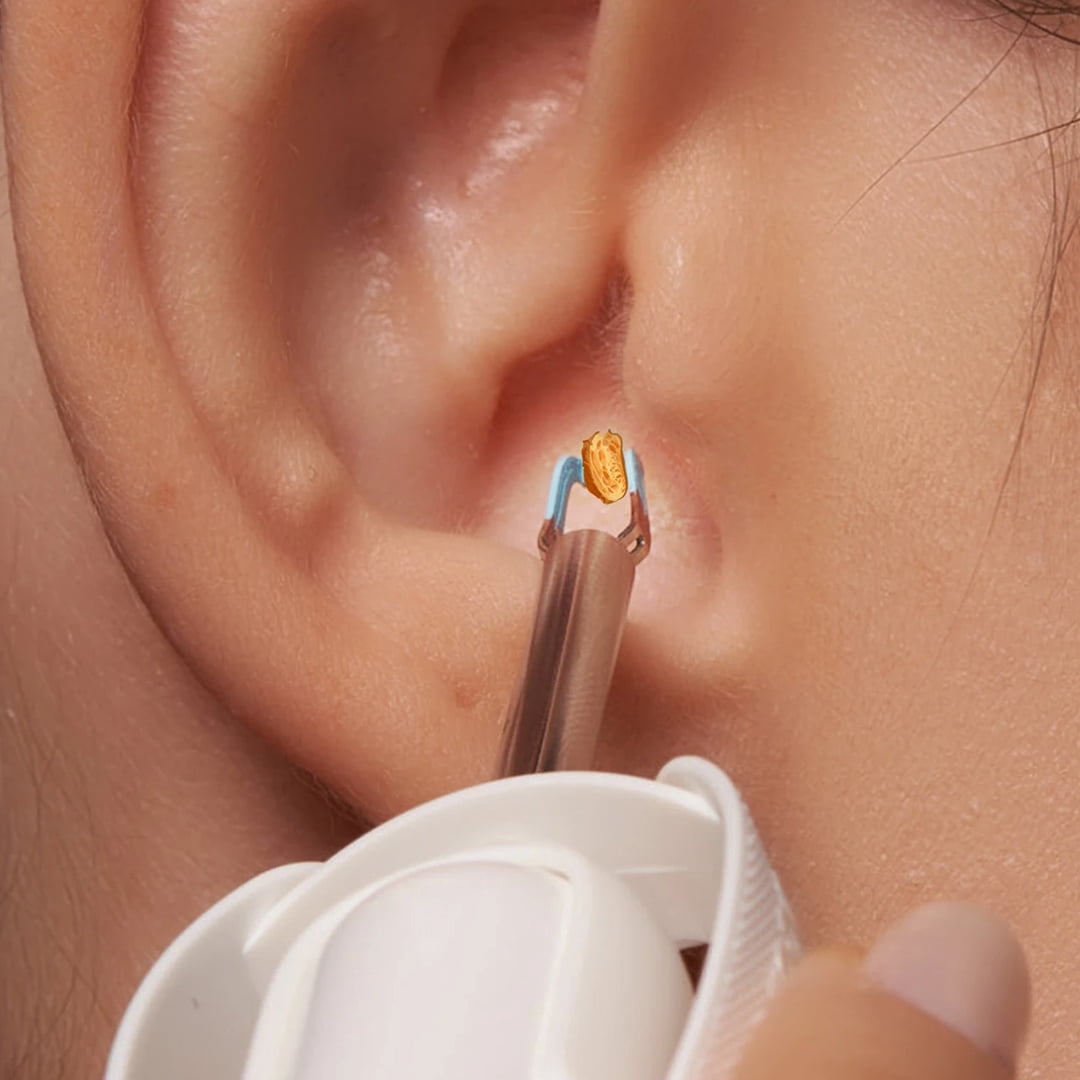 Bebird Home 30S Ear Care Pro