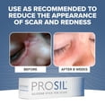 thumbnail image 4 of Barra de tratamiento de cicatrices BIODERMIS PROSIL Silicone 4,25 g, 4 of 8