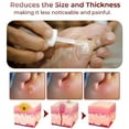 thumbnail image 4 of RAGUPEL Foot Corn Removal Gel,Liquid Corn and Callus Remover,Corn Remover Gel for Feet,Corn Removers for Toes Extra Strength,10ml (3pcs), 4 of 4