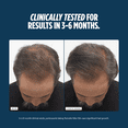 thumbnail image 4 of Nutrafol Men 50+ Hair Growth Supplements, Clinically Tested for Visibly Thicker Hair and Scalp Coverage, #1 Dermatologist-Recommended Hair Growth Supplement Brand - 1 Month Supply, 4 of 7
