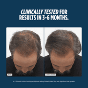 Nutrafol Men 50+ Hair Growth Supplements, Clinically Tested for Visibly Thicker Hair and Scalp Coverage, #1 Dermatologist-Recommended Hair Growth Supplement Brand - 1 Month Supply