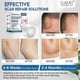 thumbnail image 4 of Silicone Scar Sheets, 2.5Cmx 1.5Mclear Scar Tape, Silicone Scar Strips, Invisible Silicone Scar Sheets, 4 of 5