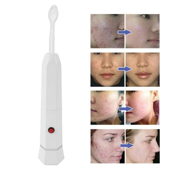 High Frequency Facial Machine, Rechargeable 4 Tubes High Frequency Facial Wand Handheld Skin Tightening for Haircare