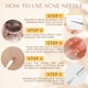 thumbnail image 2 of Kit de 16 herramientas para eliminar puntos negros y extraer granos DERMATED, 2 of 6