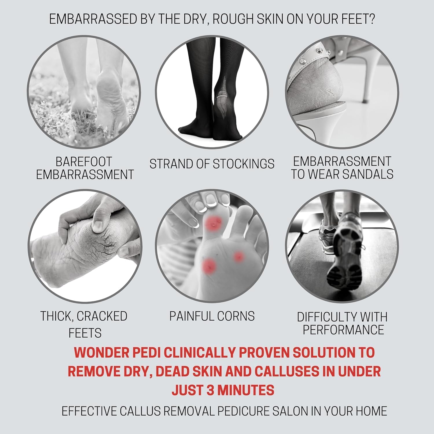 Wonder Pedi Instant Soft Foot Callus Remover Feet Softener Spray Professional Spa Quality