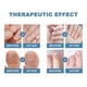 thumbnail image 4 of Pegatinas correctoras para uñas Parches correctores para uñas encarnadas Tratamiento para paroniquia Recuperación Alivio de la involución de las uñas Cuidado de los pies, 4 of 4