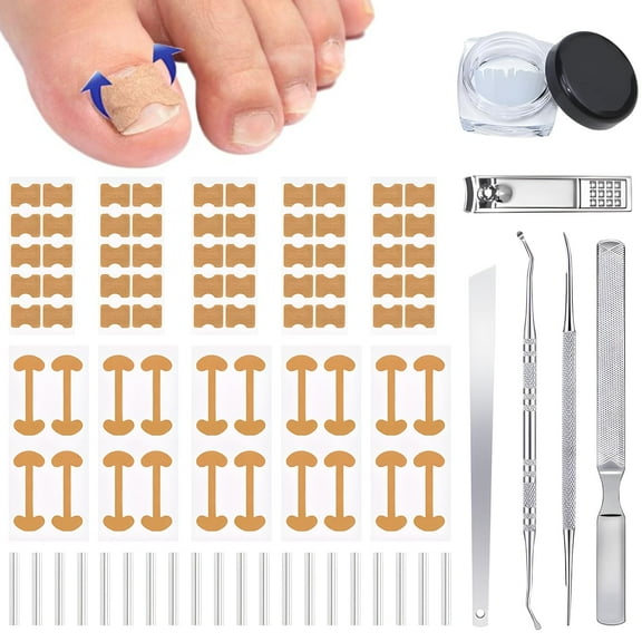 Professional Ingrown Toenail Corrector Set with Correction Strips, Ingrown Toenail Treatment Kit, Curved Toenails Corrector Patch, Painless File and Lifter Pedicure Tools for Women Man