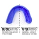 thumbnail image 5 of Protector bucal SISU 3D de 2.0 mm de grosor, azul real, para atletas, 5 of 7