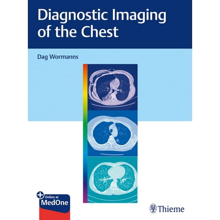 UPC: 9783132415652 | Diagnostic Imaging of the Chest (Hardcover)