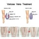 thumbnail image 5 of Crema Varices YONGSHENG 30ml, 5 of 5