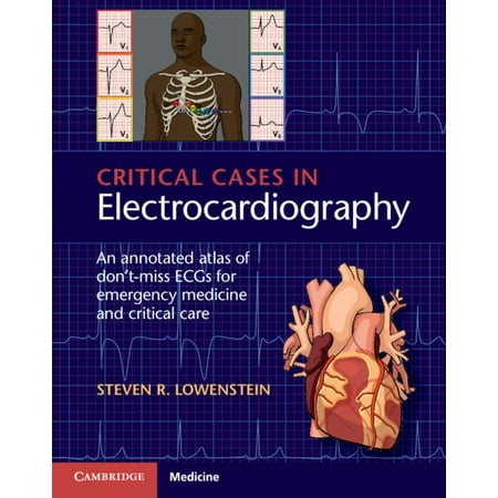 Critical Cases in Electrocardiography : An Annotated Atlas of Don't-Miss Ecgs for Emergency Medicine and Critical Care