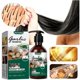 thumbnail image 1 of Garlic shampoo hair cleansing mild anti-dandruff shampoo nourishes hair soft moisturizing 1, 1 of 2