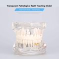 thumbnail image 2 of Diente de implante dental modelo Yosoo Health Gear, 2 of 8