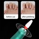 thumbnail image 3 of Minnieouse Home Salon Spa Nail Grinder Toenail Pulido eléctrico portátil Herramienta de lijado Lijadora de velocidad rápida Eliminación de gel Juegos de manicura Oro, 3 of 6