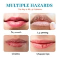 Dry Cracked Lips Healing Lip Balm for Severely Chapped Lips Designed Cheilitis Treatment